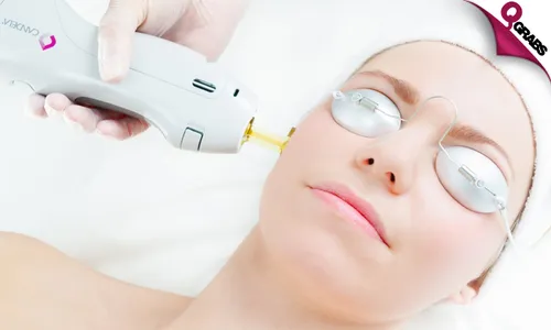 Laser Hair Removal Sessions!